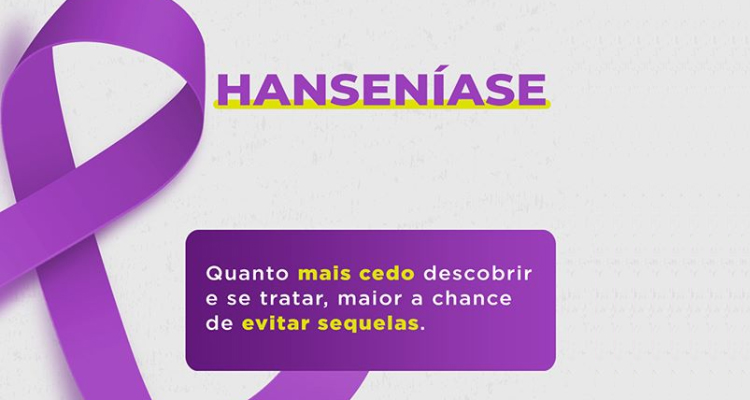 SBD: Janeiro Roxo – Hanseníase: Faça parte da luta contra o